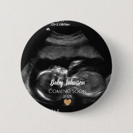 Baby Coming Soon Ultrasound Gold heart Button