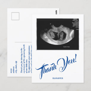 Baby Dusche Ultrasound Boy Blue Vielen Dank. Postkarte