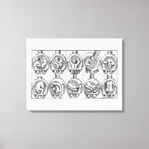 Baby im Mutterleib Vintage-Hebamme Anatomie-Illust Leinwanddruck