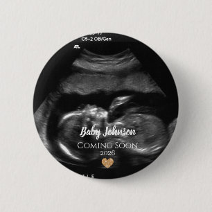 Baby kommt bald Ultraschall Gold Herz Button