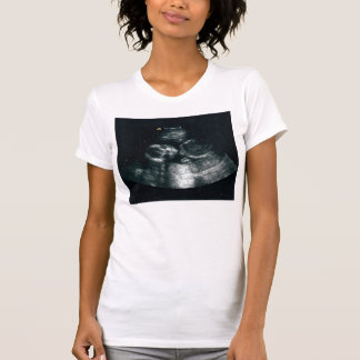 Baby nach innen T-Shirt