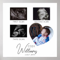 Baby Scan Foto Sonogramm Baby Keeper