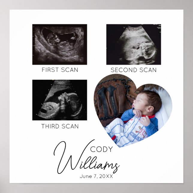 Baby Scan Foto Sonogramm Baby Keeper Poster (Vorne)