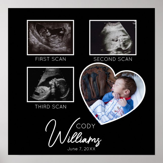 Baby Scan Foto Sonogramm Baby Keeper Poster (Vorne)