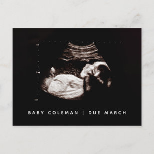 Baby Sonogram Pregnancy Ankündigung Foto Postkarte