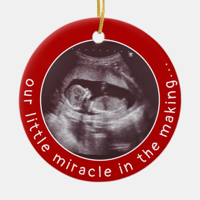 Baby Ultrasound Foto Red Miracle Weihnachten Keramik Ornament (Vorne)