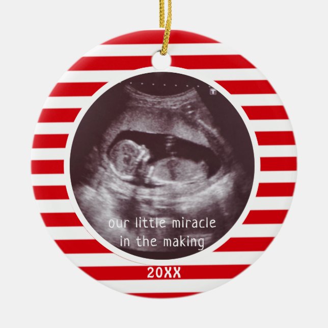 Baby Ultrasound Foto Red White Strip Weihnachten Keramik Ornament (Vorne)