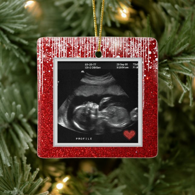 Baby Ultrasound kommt bald Foto Keramikornament (Baum)