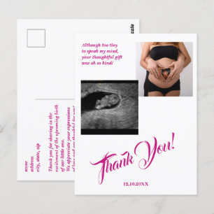 Babydusche Ultrasound Girl Pink Vielen Dank. Postkarte