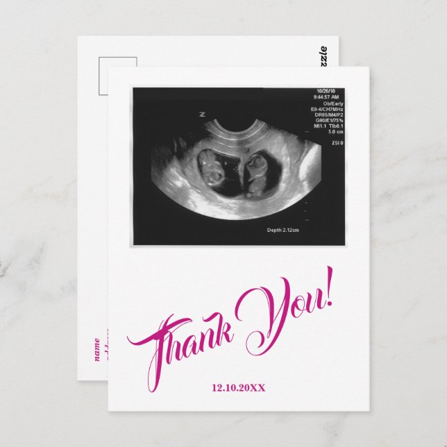 Babydusche Ultrasound Girl Pink Vielen Dank. Postkarte (Vorne/Hinten)