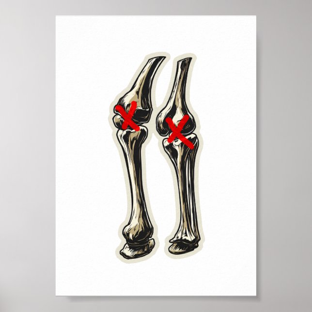 Bad Knees – Funny Skeleton Knee Illustration Poster (Vorne)
