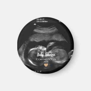 Bald kommt Baby Sonogramm-Ankündigung Magnet