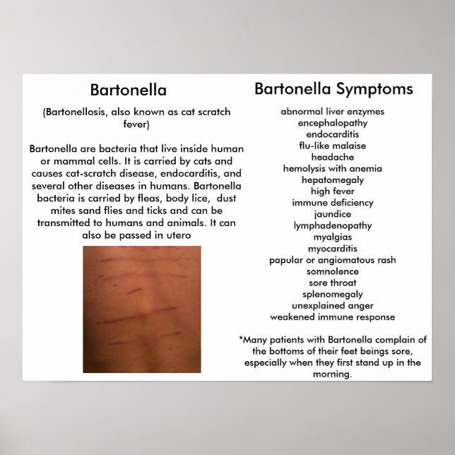Bartonella Symptome Lernposter Poster (Vorne)