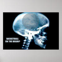 Basketballkopf (Röntgen)