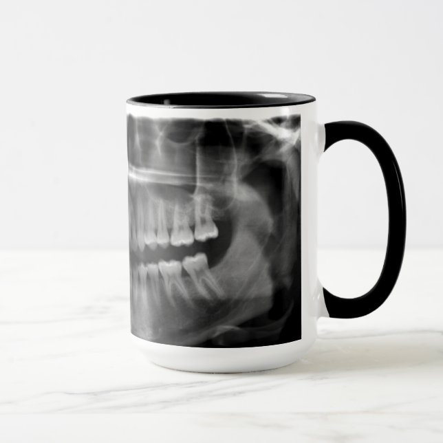 Becher Panorama Röntgenaufnahme Tasse (Rechts)