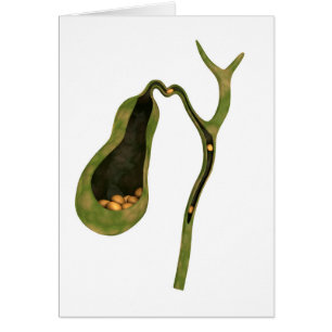 Begriffsbild der Gallenstein-Innere-Abschürfung