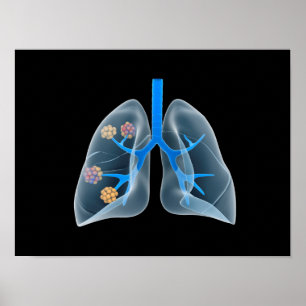 Begriffsbild menschlichen Herzens 4 Poster