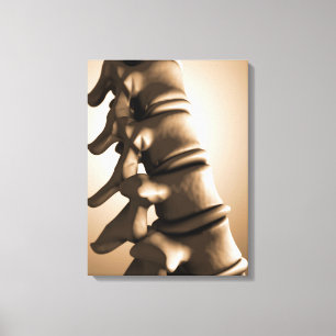 Begriffsbild menschlichen Rückgrats 4 Leinwanddruck