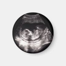 Benutzerdefiniertes Baby-Ultraschall-Schwangerscha