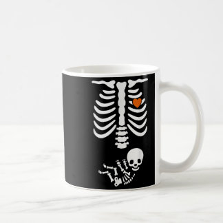 Bierbauch & Amp; Baby Skeleton Schwangerschaft Paa Kaffeetasse