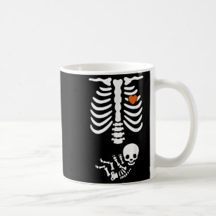 Bierbauch & Amp; Baby Skeleton Schwangerschaft Paa Kaffeetasse