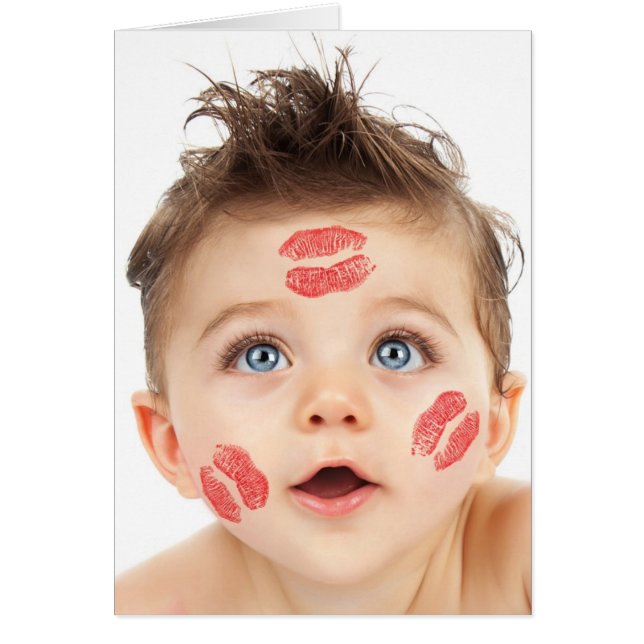 Bild der kleinen Niedlichen Kupille (Vorne)