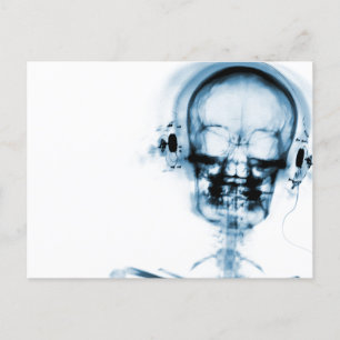 Blue X-Ray Vision Music Skeleton Skull Postkarte