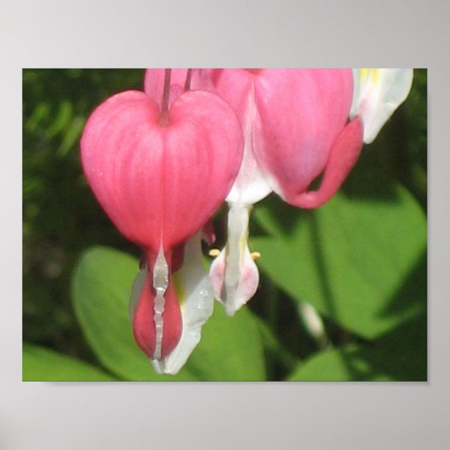 Blutergüsse Herz-Poster - Mattwertpapier Poster (Vorne)