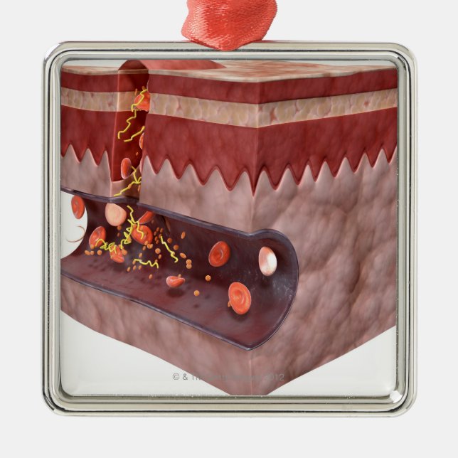 Blutgerinsel-Bildung Silbernes Ornament (Vorne)