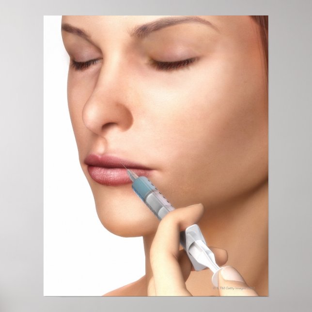 Botox Injektionen Poster (Vorne)