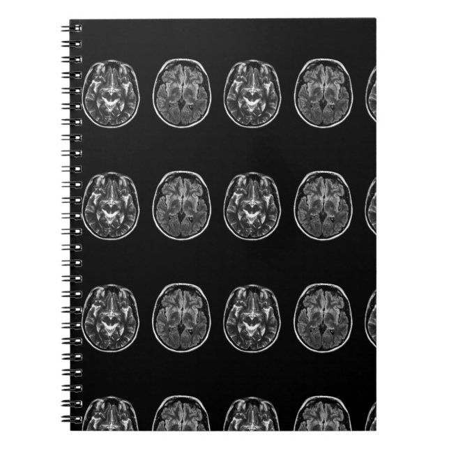 Brain Mri Scan Notizblock (Vorderseite)
