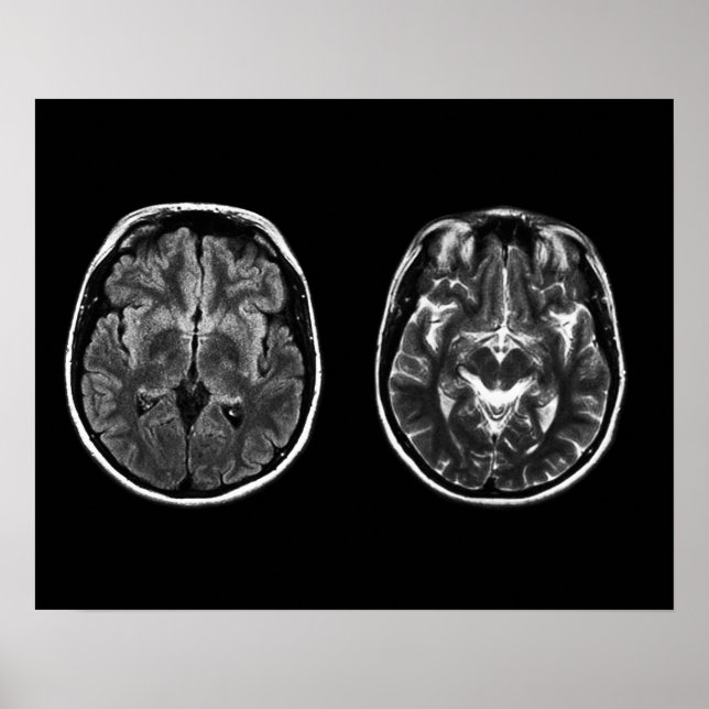 Brain Mri Scan Poster (Vorne)