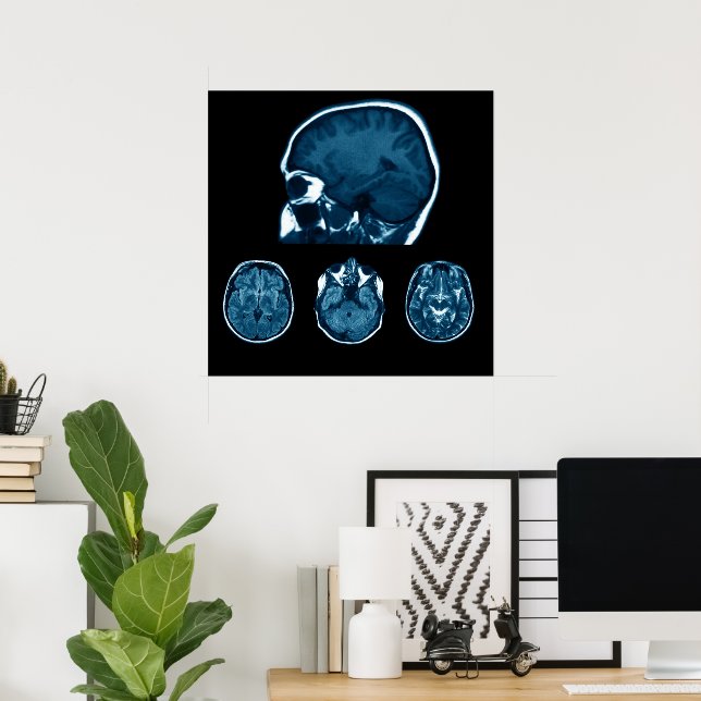Brain Mri scan Poster (Heimbüro)