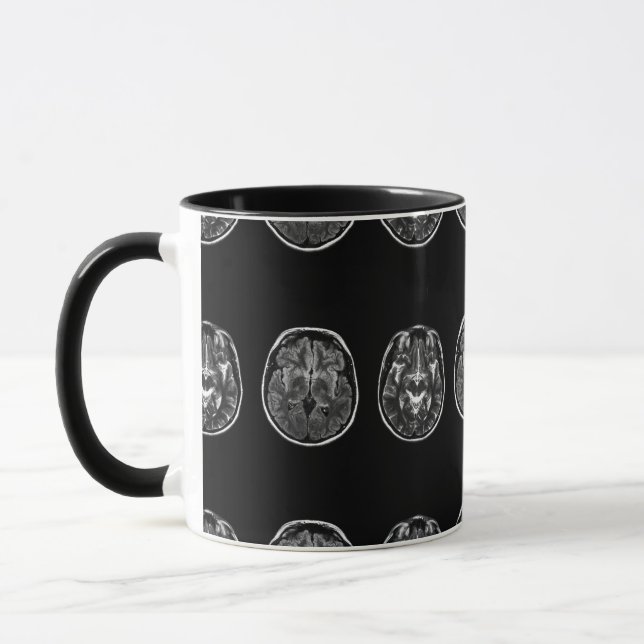 Brain Mri Scan Tasse (Links)