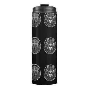 Brain Mri Scan Thermosbecher