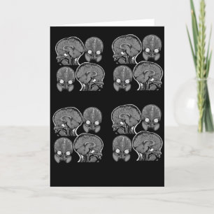 BRAINS! (MRI) KARTE