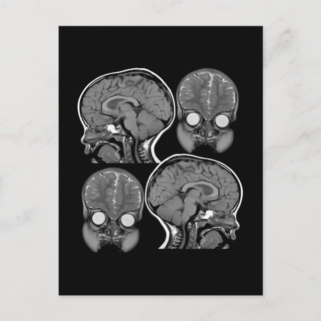BRAINS! (MRI) POSTKARTE (Vorderseite)
