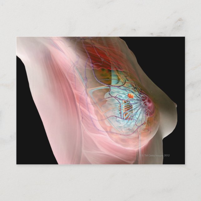 Brustkrebs Postkarte (Vorderseite)