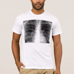 Brustradiographie T-Shirt