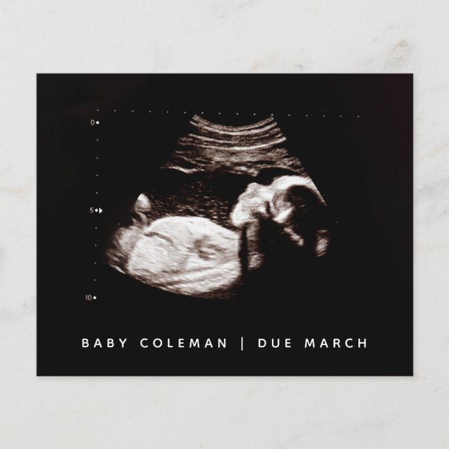 Budget Pregnancy Baby Sonogram Ultrasound Foto (Vorderseite)