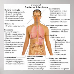 Chart of the Main Bacterial Infections in Humans Poster