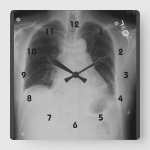 Chest X Ray ~ Clock Quadratische Wanduhr
