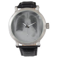 Chest X Ray ~ watch