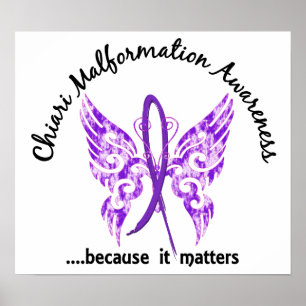 Chiari Malformation Butterfly 6,1 Poster