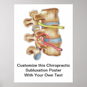 Chiropractic Subluxation Poster individuell gestal