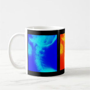 Chiropraktik-Kaffeetasse, Reise-Tassen und Steins Tasse