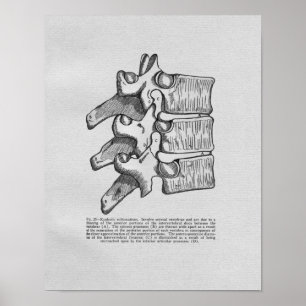 Chiropraktiksubluxations-Vintager Druck Poster