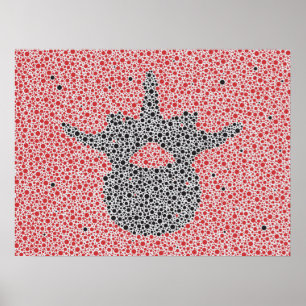 Chiropraktische Anatomie Artwork Lumbar Vertebrae Poster