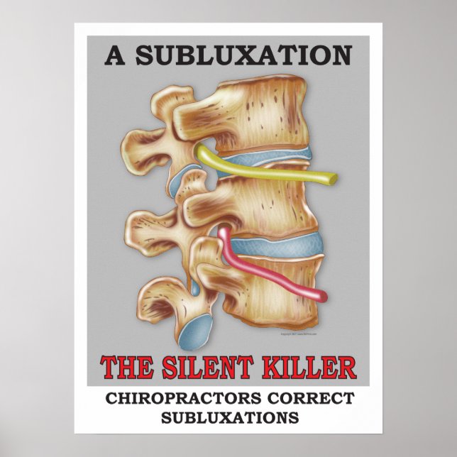 Chiropraktische Subluxation Stille Killer Poster (Vorne)
