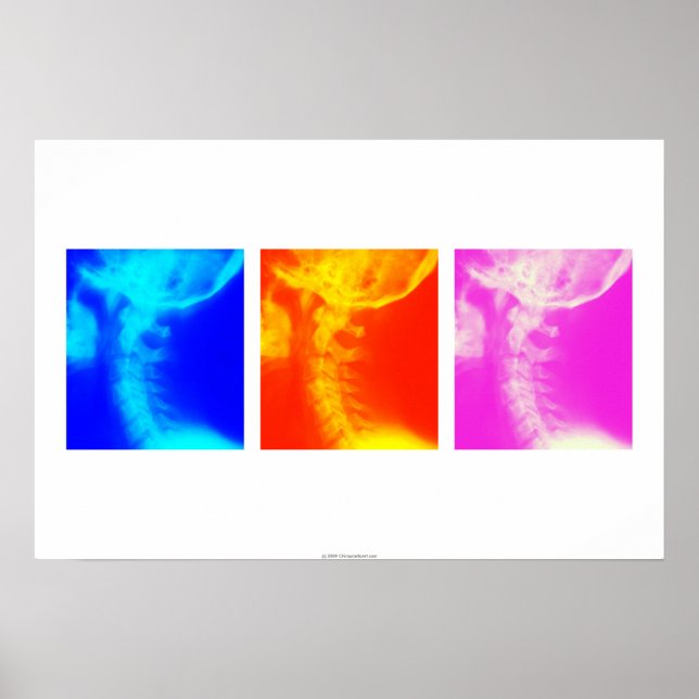 Chiropraktisches Poster 2 (Vorne)